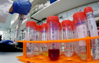 Le Royaume-Uni durcit ses relations envers la Chine suite au scandale des kits de détection contaminés