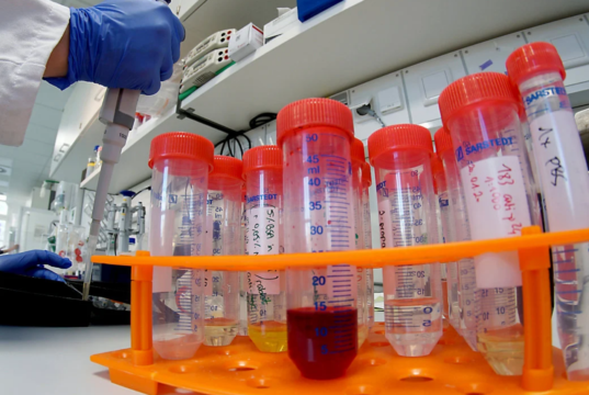 Le Royaume-Uni durcit ses relations envers la Chine suite au scandale des kits de détection contaminés